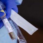 Κορωνοϊός: Πώς κατανέμονται τα χθεσινά κρούσματα στην Π.Ε. Φλώρινας