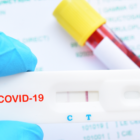 Δωρεάν ατομικά rapid test για κάθε πολίτη μια φορά την εβδομάδα